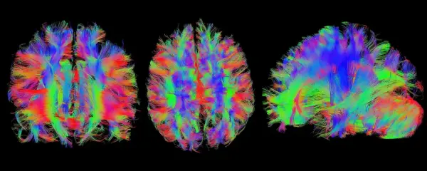 Bunte Faserbahnen des Gehirns, die die komplexen Verbindungen für kognitive Wissenschaft darstellen.